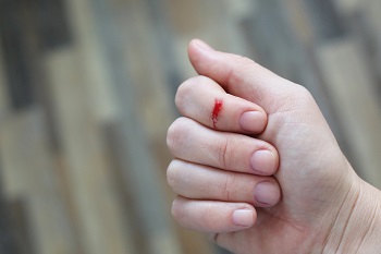 How Long Do Paper Cuts Take to Heal? Complete Timeline and Faster Healing Tips